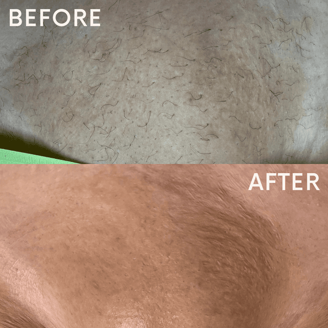 3 Months Brazilian Package at Metanoia Beauty in Lubbock, TX